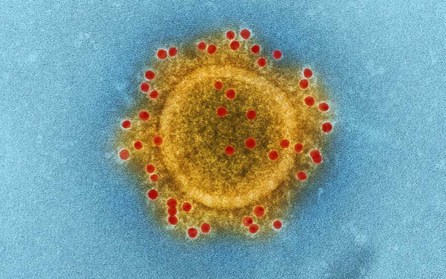 Aconteceu a primeira morte pelo coronavírus no Brasil